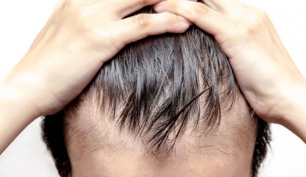 saç dökülme nedenleri nelerdir? saç dökülme nasıl önlenir?