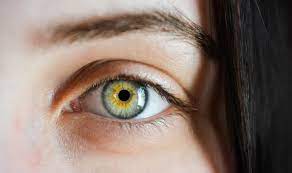 Renkli gözler neden hemen bozulur Renkli gözlerin tedavisi nasıl olur