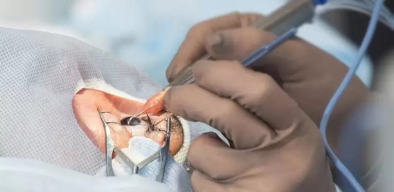 Göz sağlığı, yaşam kalitesini doğrudan etkileyen önemli bir unsurdur. Lazer