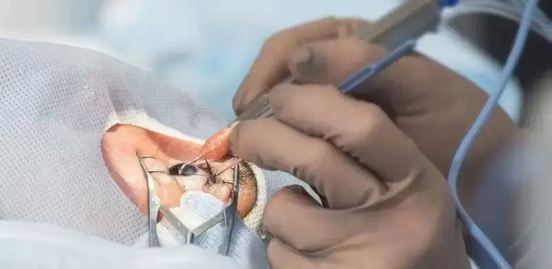 Göz sağlığı, yaşam kalitesini doğrudan etkileyen önemli bir unsurdur. Lazer