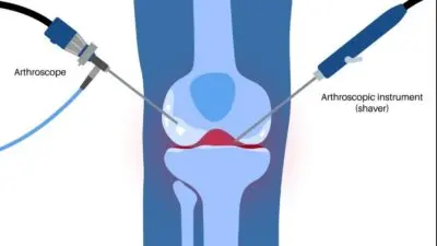 &nbsp; Diz eklemi, vücudumuzun en karmaşık ve en çok yük